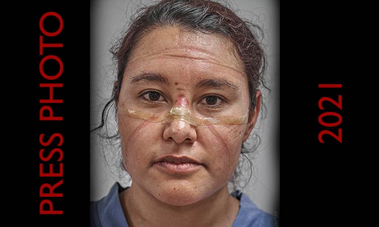 El World Press Photo 2021, para fotógrafo que retrató a doctora mexicana que combate al Covid-19
